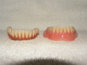 Types of Dentures
